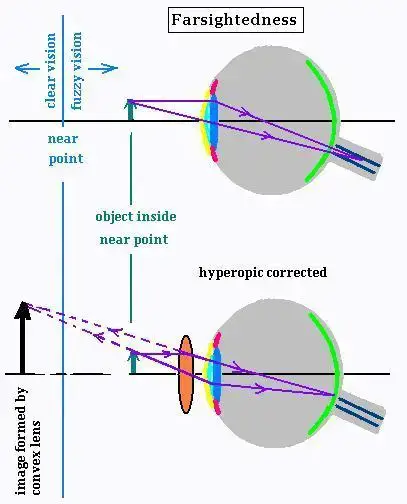 Optics