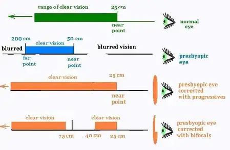 Optics