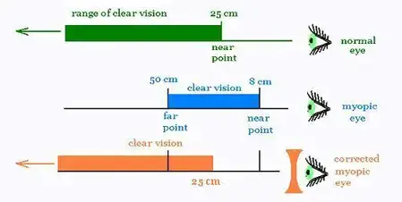 Optics